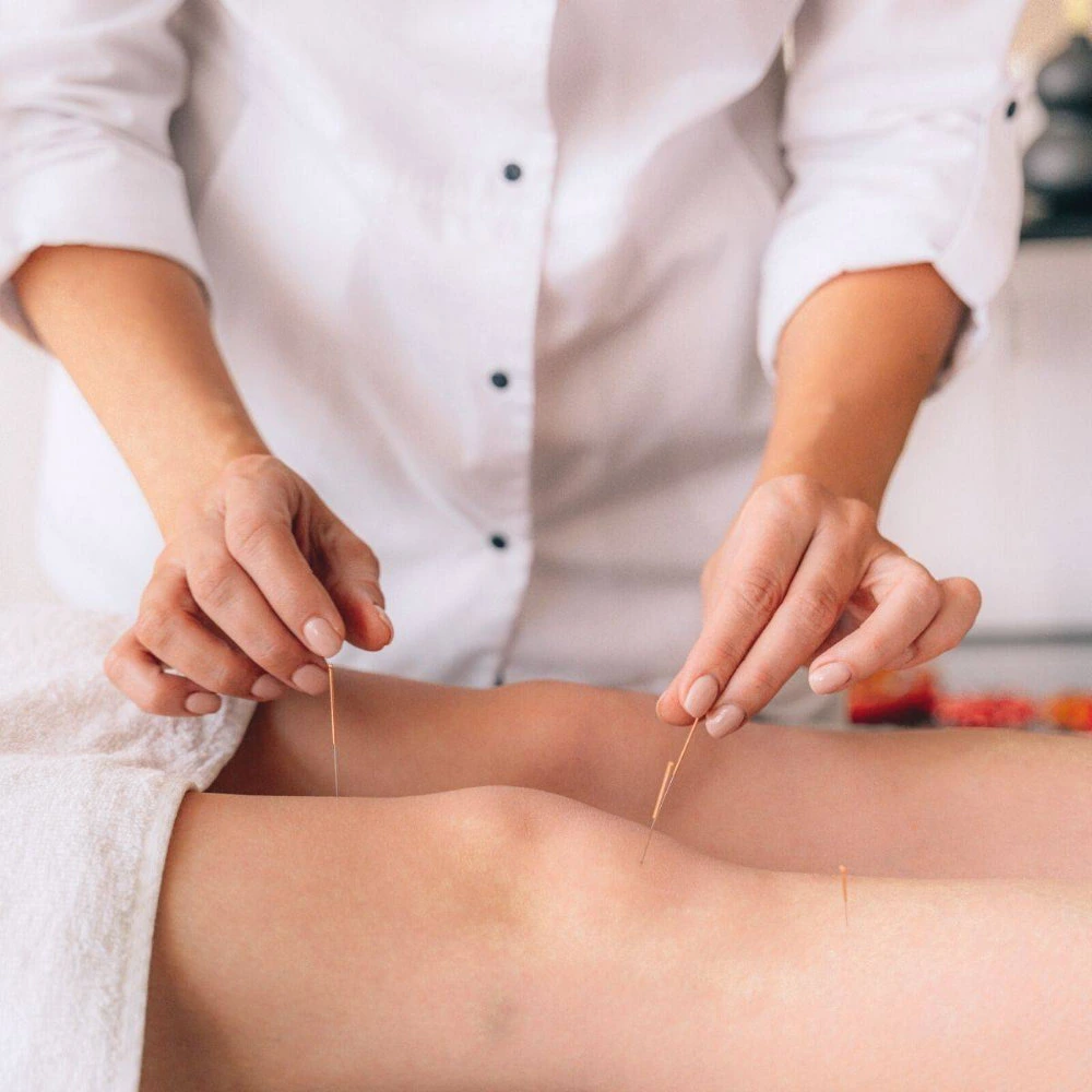 Acupuncture treatment