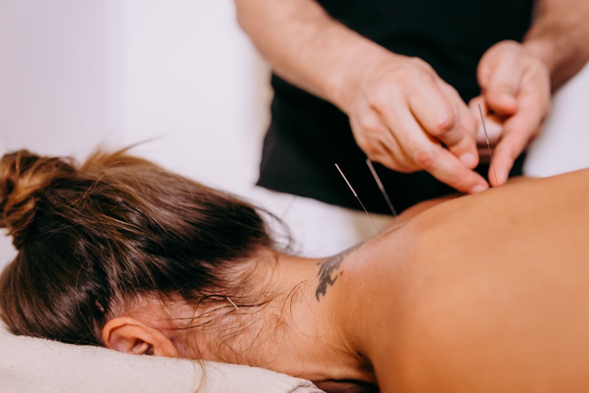 Acupuncture treatment session at Aujaswa Clinic